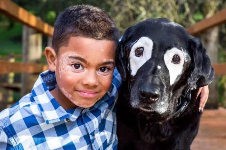 Menino com vitiligo faz amizade com cachorro que tem a mesma condição 