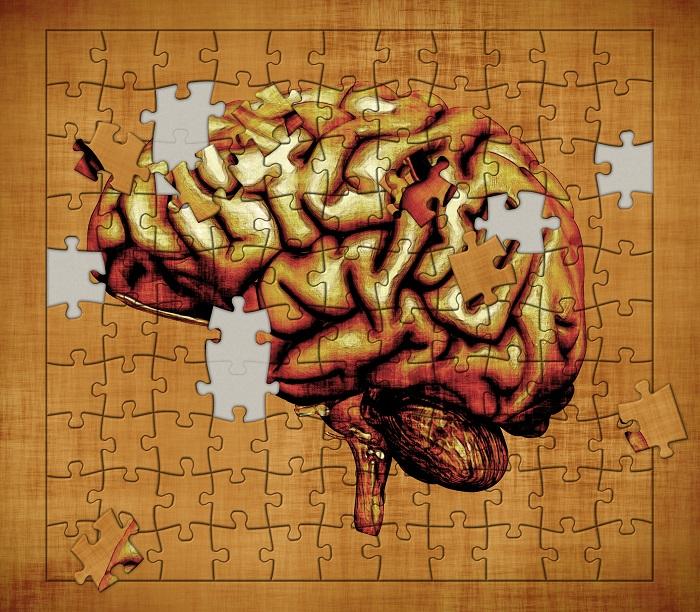 Parkinson: o que acontece no cérebro com a doença 
