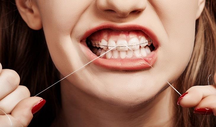 A importância do fio dental: sabia que apenas 57% dos brasileiros o utilizam? 