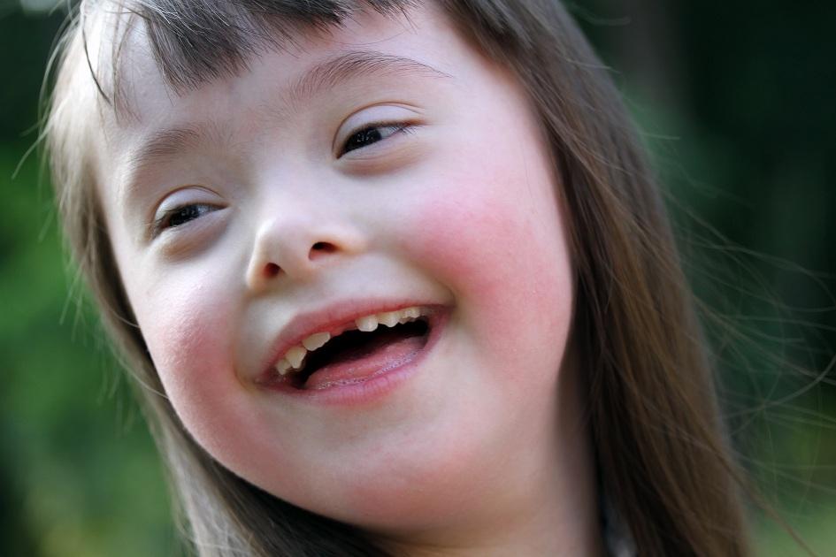 Inclusão de pessoas com síndrome de Down: 5 dicas especiais para facilitar esse processo 