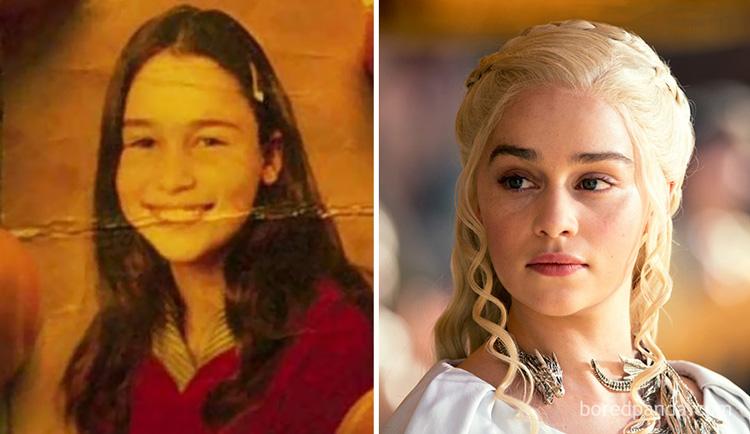 Emilia Clarke antes e depois GOT