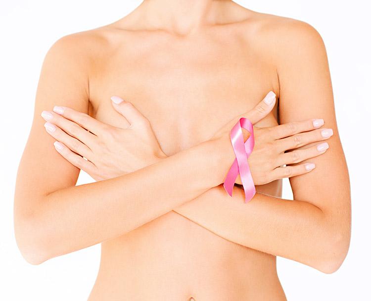 O câncer de mama é um dos mais recorrentes no Brasil