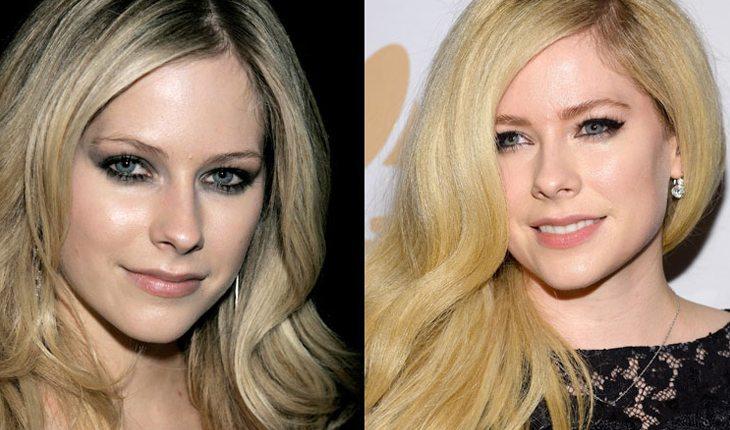Na imagem há o antes e depois da cantora Avril lavigne