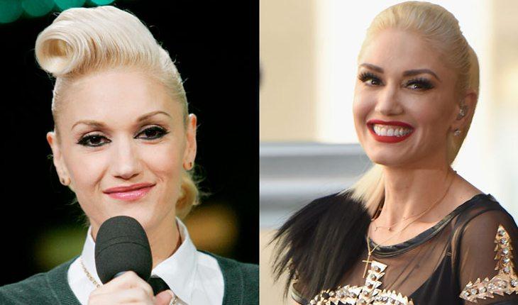 Na imagem há o antes e depois da cantora Gwen Stefani
