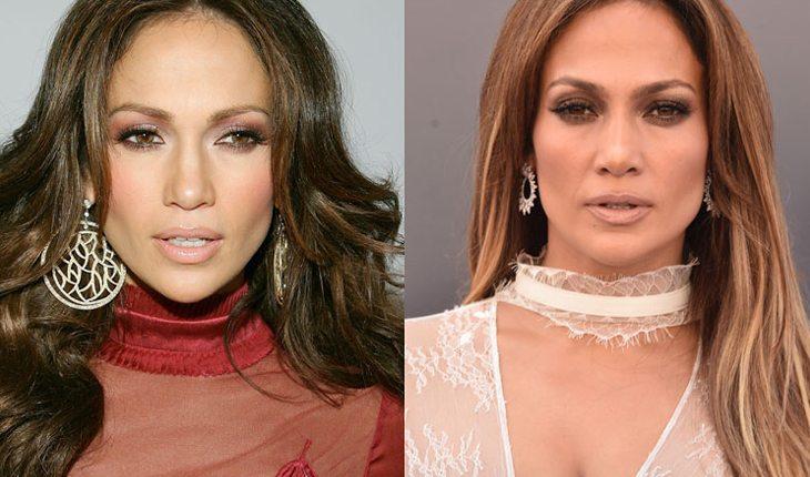 Na imagem há o antes e depois da cantora Jennifer Lopez