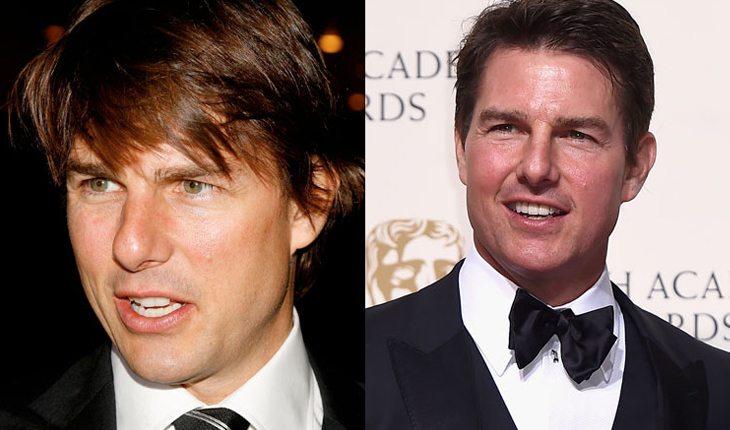 Na imagem há o antes e depois do ator Tom Cruise