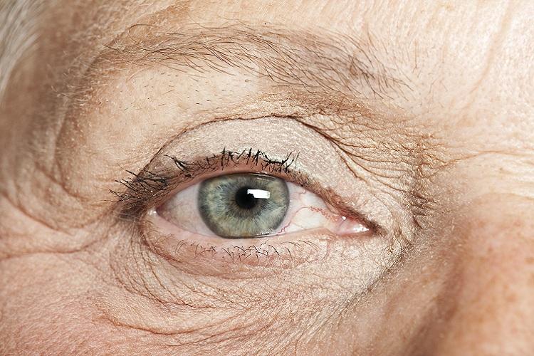 olho verde idosa alzheimer