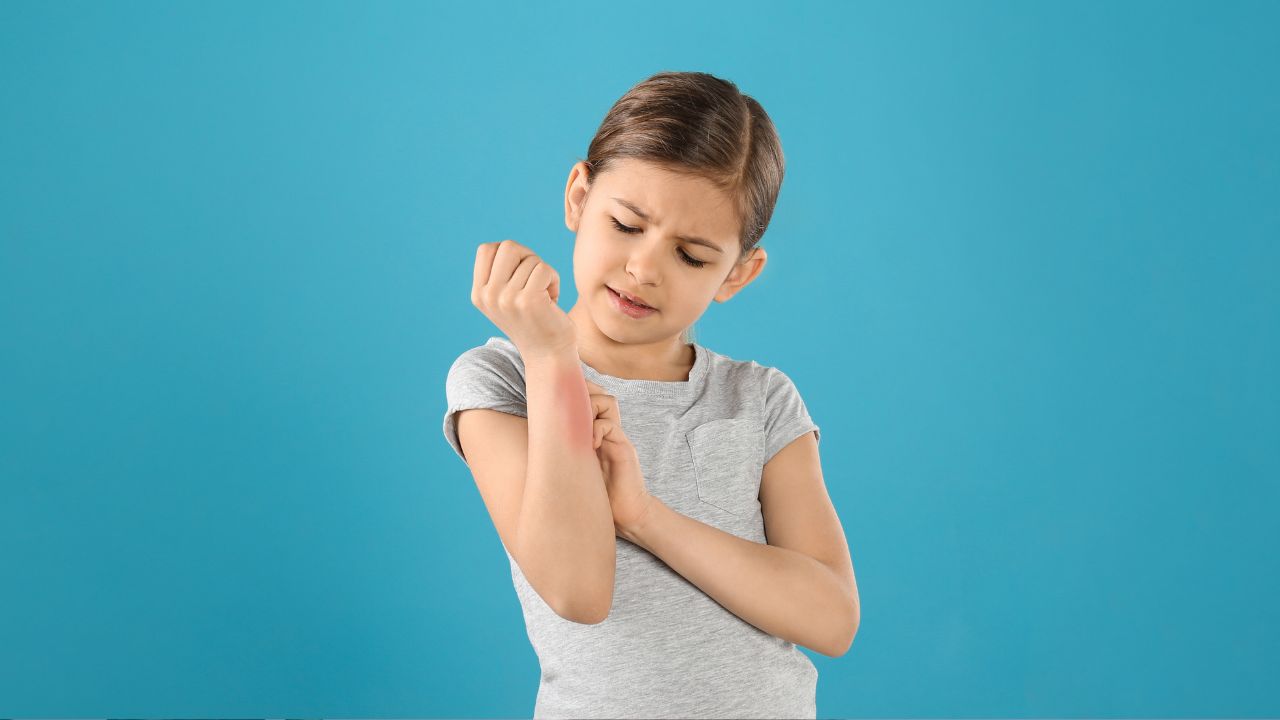 Pediatra aponta as reações mais frequentes e explica sobre os quadros alérgicos na infância