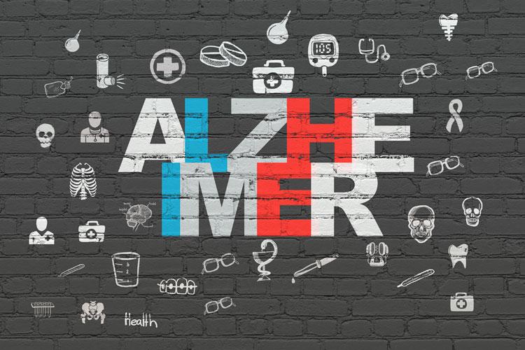 O Alzheimer é uma doença multifatorial, e os hábitos adotados durante a vida podem influenciar ou não no surgimento da doença. Confira quais são!