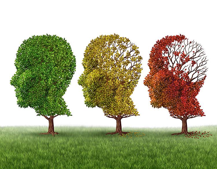 Conheça os sintomas do Alzheimer 