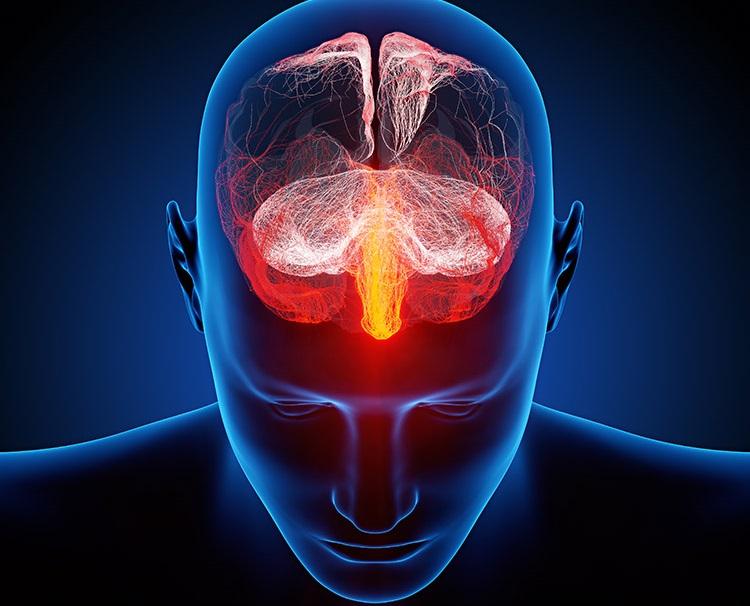 Ciência já descobriu que esquizofrenia é causada por alterações estruturais no cérebro. Sinapses e quantidades de neurotransmissores também são afetadas