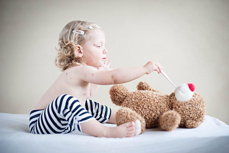 Confira os sintomas de sarampo, micose e icterícia, doenças que afetam as crianças e bebês e veja como cuidar