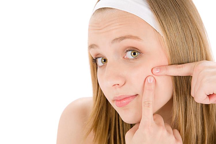 Espinha ajuda a manter a pele mais jovem na vida adulta 