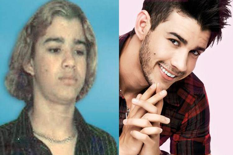 Antes e depois: veja 9 famosos que evoluíram no quesito beleza 