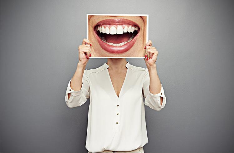 Clareamento dentário: 4 respostas para as dúvidas mais comuns 