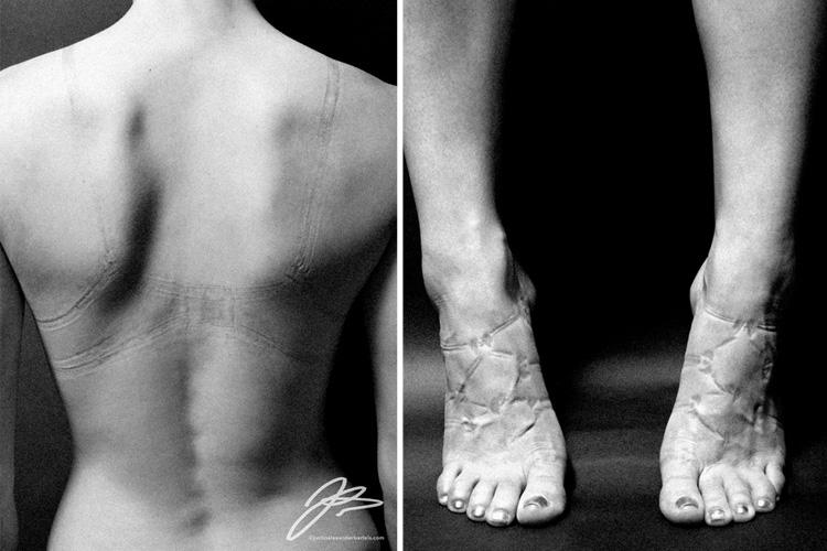 Fotos chocantes mostram marcas no corpo das mulheres nome da beleza 