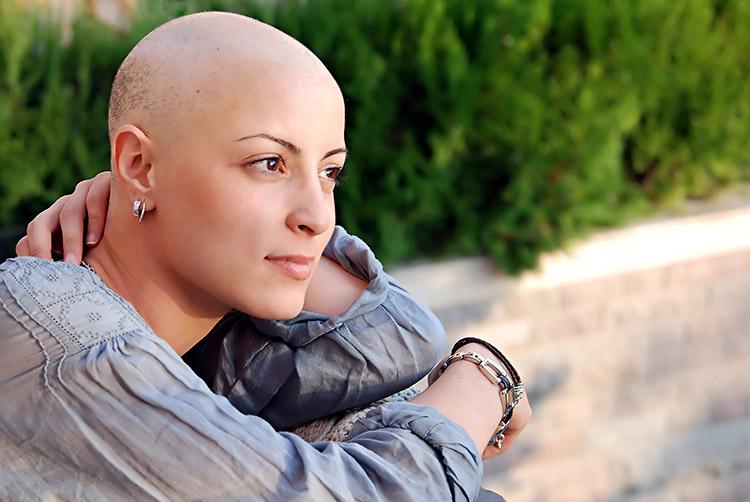 Quimioterapia: saiba como driblar a queda de cabelo 