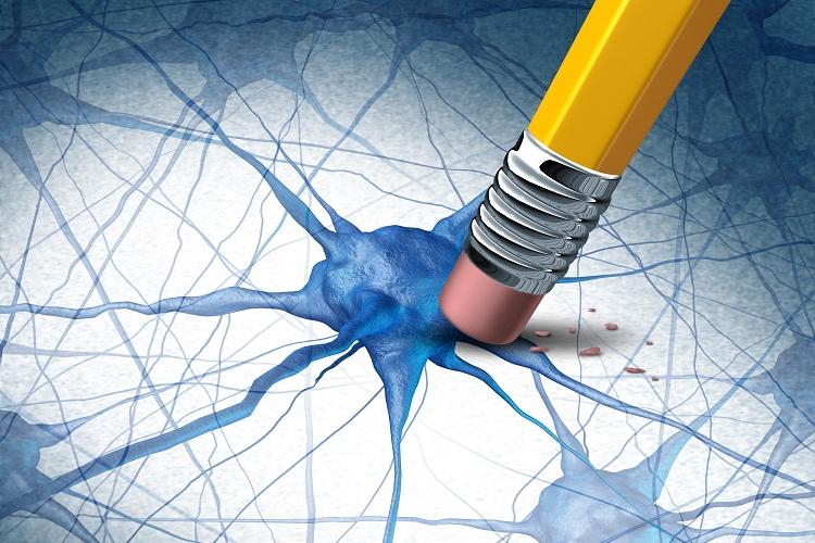 Alzheimer: entenda como a doença age no cérebro 