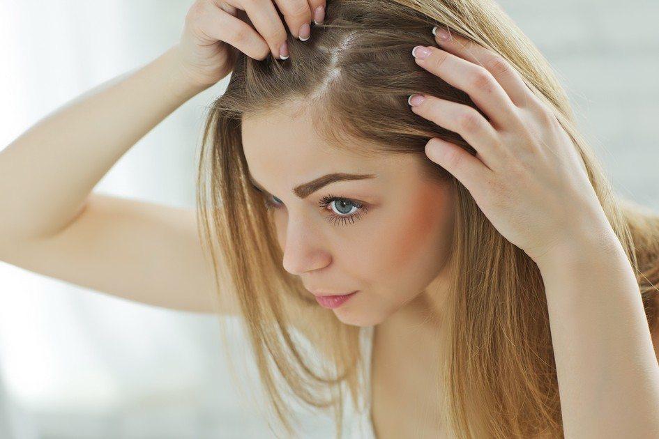 A oleosidade no cabelo é um fator presente em muitos fios e que pode ser resolvido, ou ao menos amenizado, com algumas dicas simples pra se adotar no dia a dia!