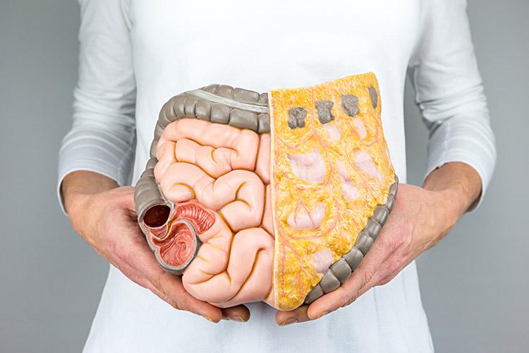 O intestino desregulado pode resultar em vários problemas para a saúde, como gases em excesso e prisão de ventre. Entenda mais sobre esse assunto!