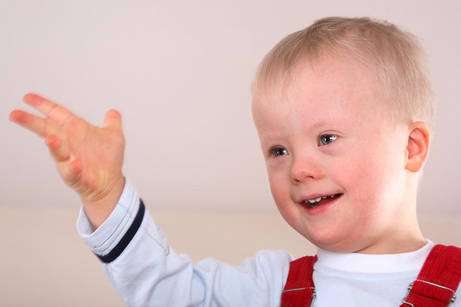 Bebê com síndrome de Down: quais os cuidados durante a gestação? 