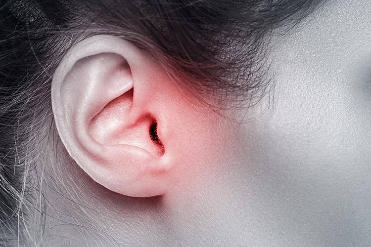 O ouvido merece atenção, pois uma simples dor de ouvido pode se tornar um grande problema. Além disso, é importante ter alguns cuidados!