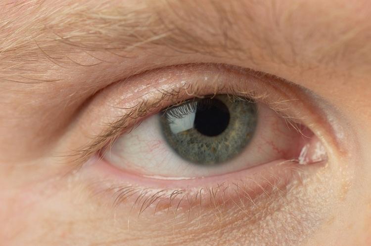 Glaucoma e catarata podem levar à cegueira. Saiba como identificá-los! 