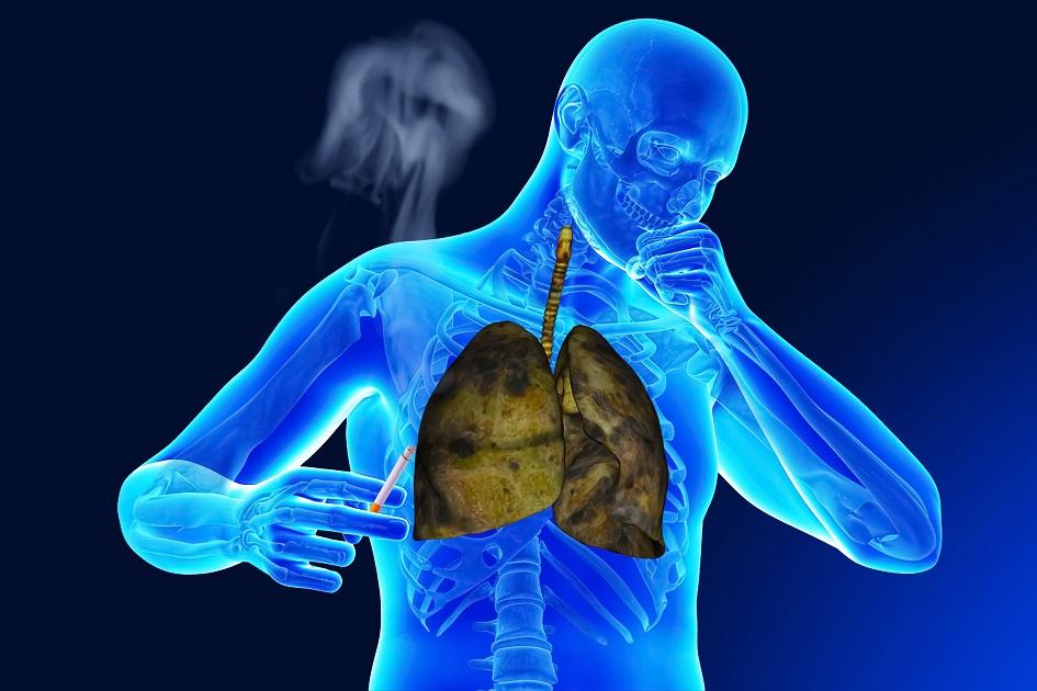 As vezes pode parecer um incomodo simples, mas a tosse, quando em excesso, pode ser sintoma de graves doenças respiratórias