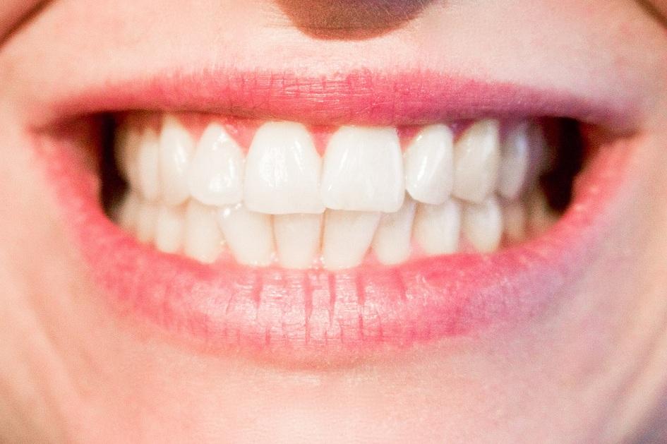 A limpeza correta da boca e dos dentes pode evitar o desenvolvimento desequilibrado de bactérias bucais e consequente desenvolvimento de doenças