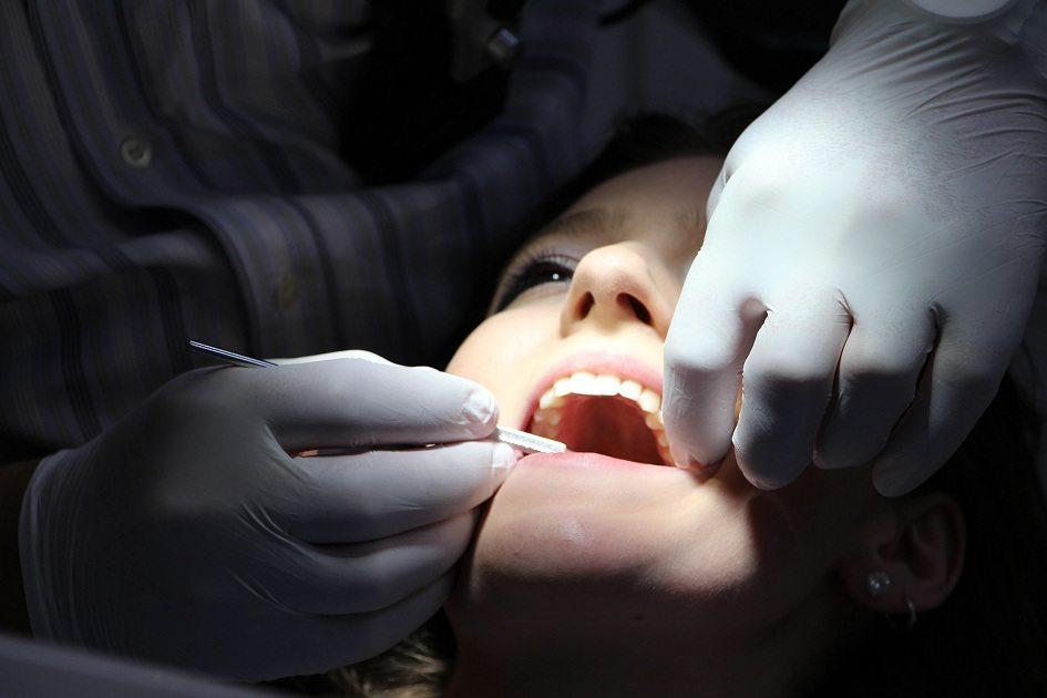 Mitos e verdades sobre o dente siso 