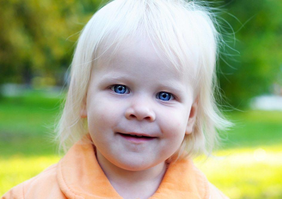 Albinismo: acompanhamento desde a infância é fundamental 