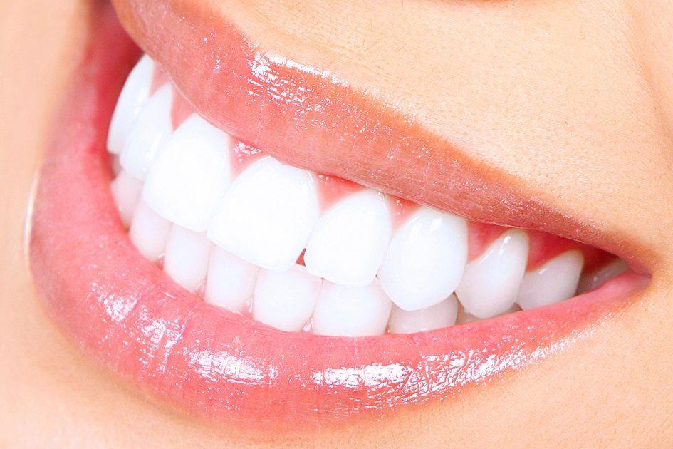 Conquiste dentes claros, hálito fresco, lábios lisinhos e gengivas saudáveis fazendo apenas o uso dos produtos naturais corretos