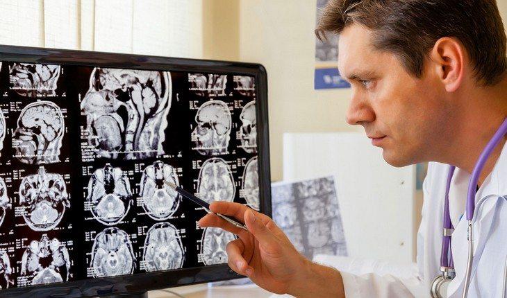 Novo tratamento para esclerose múltipla: conheça um medicamento descoberto para os portadores da doença 