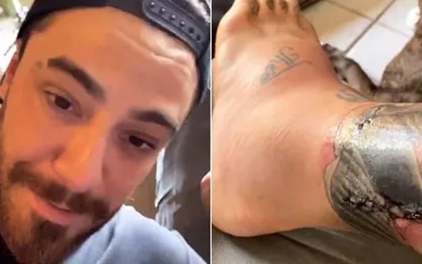 Ator Felipe Titto, de 33 anos, levou uma mordida de seu cachorro Thor e levou 15 pontos. Global usou o Instagram para atualizar fãs sobre recuperação.