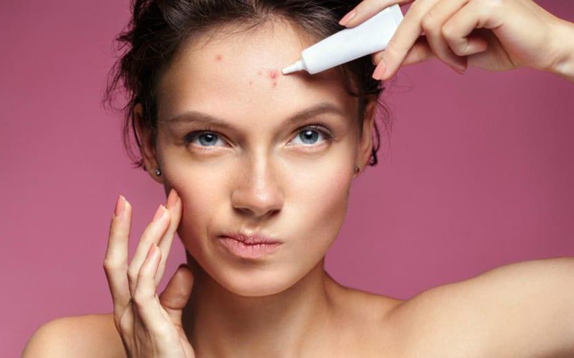 Como tratar espinhas em casa? Truques para evitar a acne 