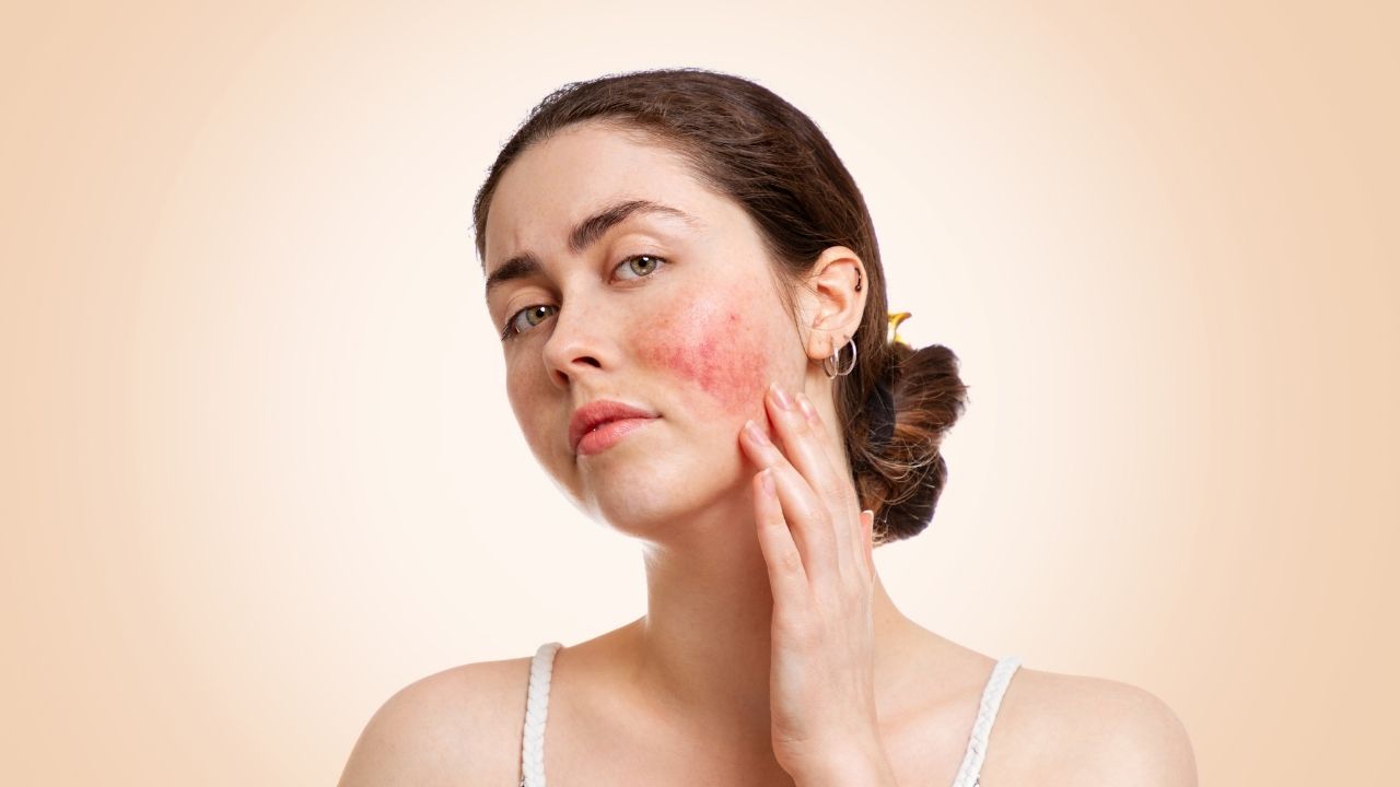 Descubra 3 fatores que deixam a pele mais irritada e sensível!