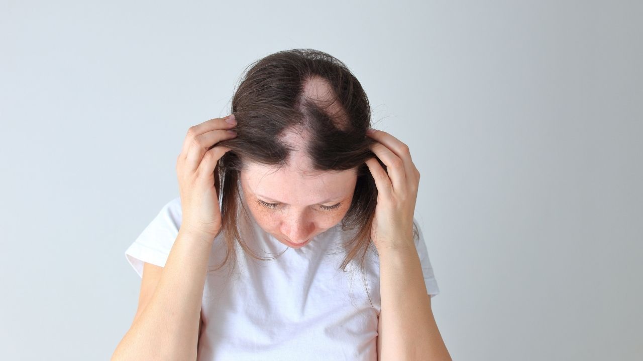 Queda de cabelo pode ser sinal de doença
