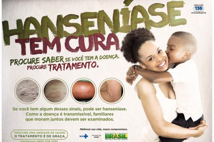 FOTO: Divulgação/Ministério da Saúde