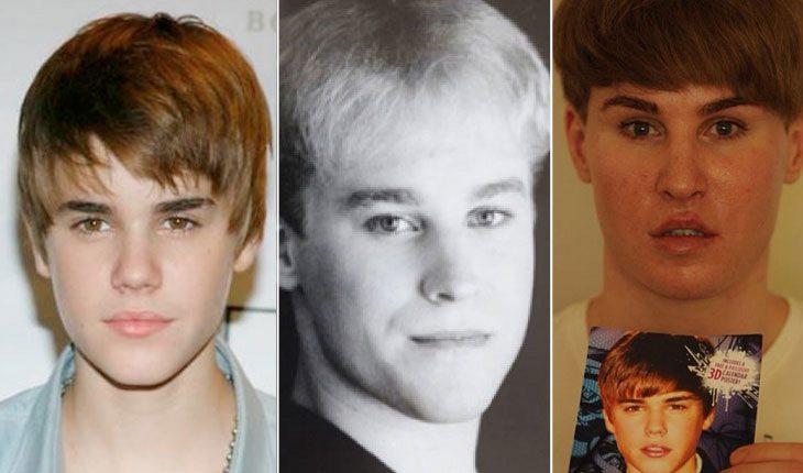 3 fotos, sendo uma do Justin Bieber, outra de Toby Sheldon antes das cirurgias e outra depois