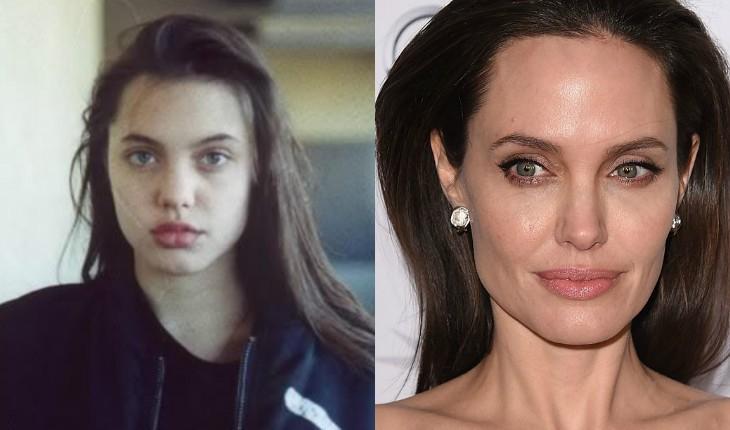 Antes e depois de Angelina Jolie