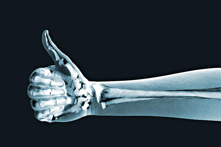 radiografia, exposição, raios x, mão fazendo sinal de aprovação, sinal de positivo, polegar levantado