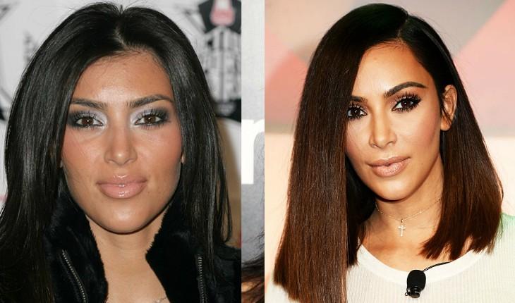 Antes e depois de Kim Kardashian