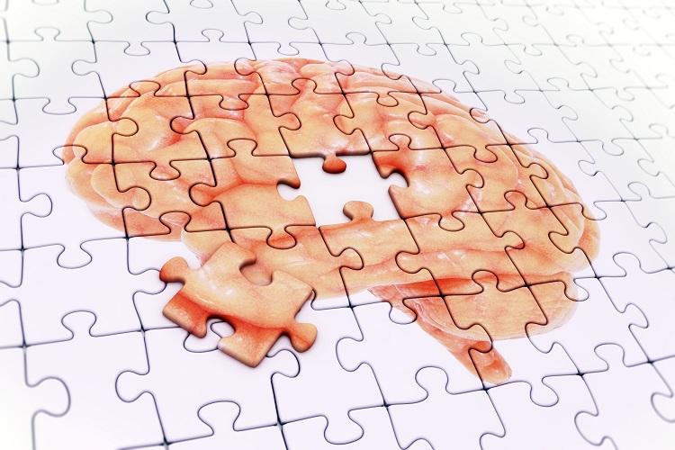 cérebro quebra-cabeça - memória