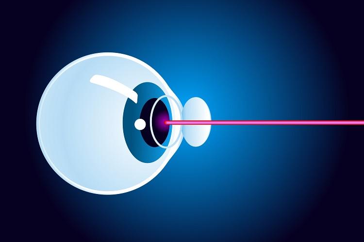 imagem de um olho recebendo laser de cirurgia