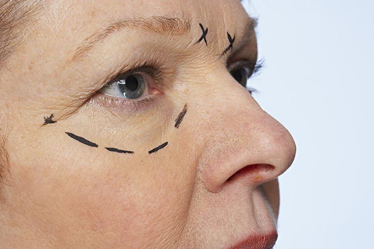 rosto-mulher-desenhado-caneta-olhos-cirurgias