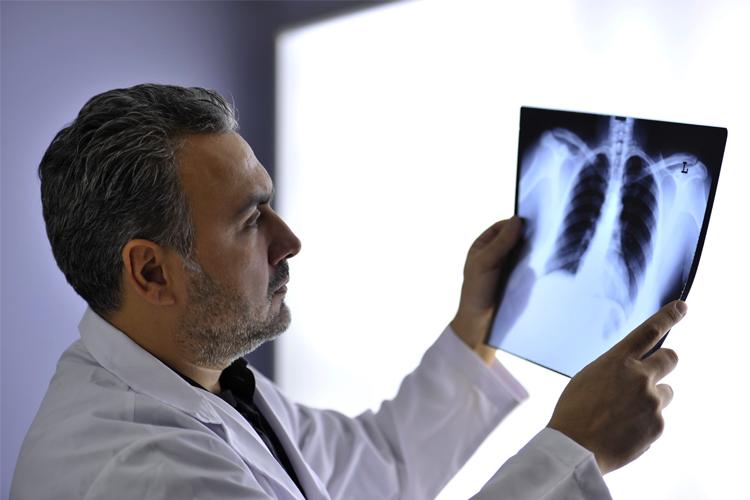 Médico olhando um raio-X