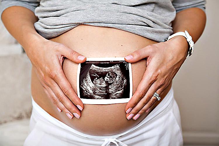 Mulher, grávida, imagem do bebe