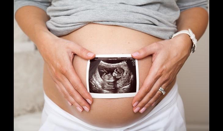 mulher grávida segurando ultrassom