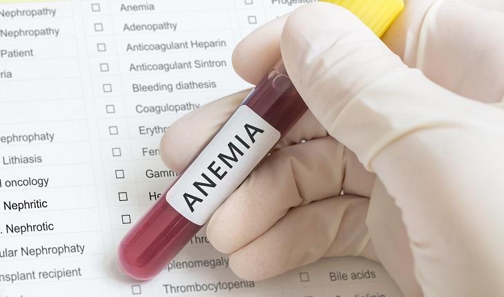 teste sanguíneo para verificar anemia.
