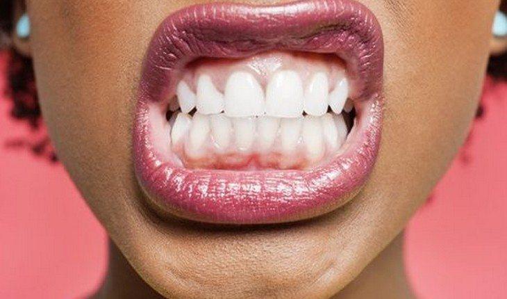 Dentes bonitos, rosto em hamornia: um sorriso perfeito transmite uma aparência jovial, feliz e radiante!